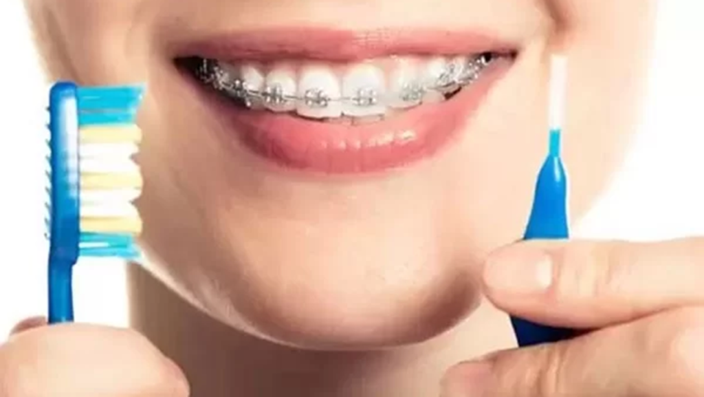 ارتودنسی دندان پوسیده
