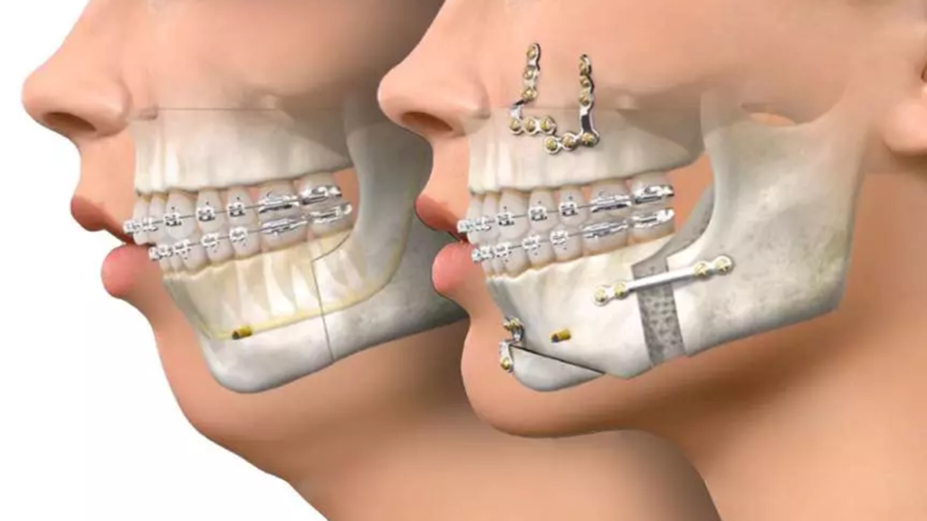 درمان ناهنجاری فک و دندان‌