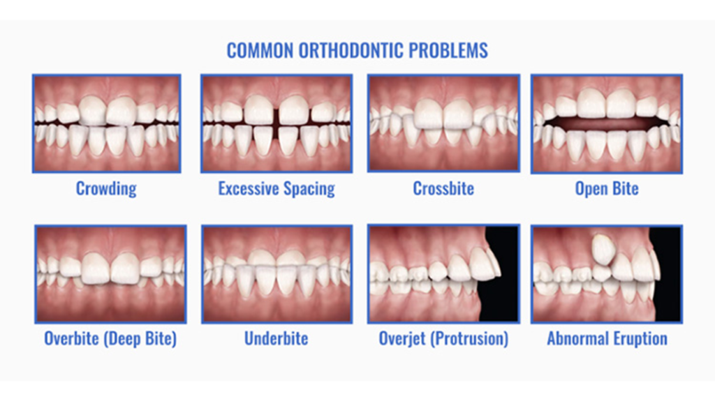 مشکلات رایج ارتودنسی