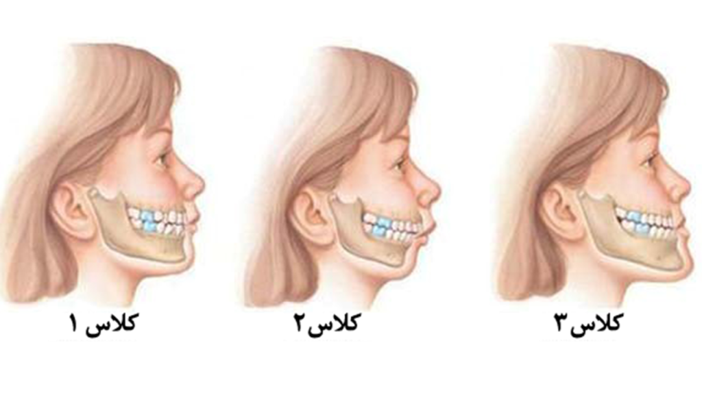 رفع مشکلات اسکلتی