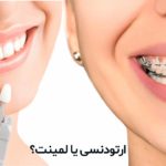 ارتودنسی یا لمینت