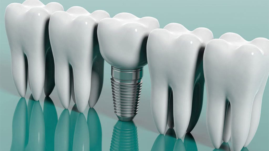کاهش هزینه های دندانپزشکی