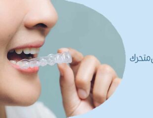 ارتودنسی متحرک