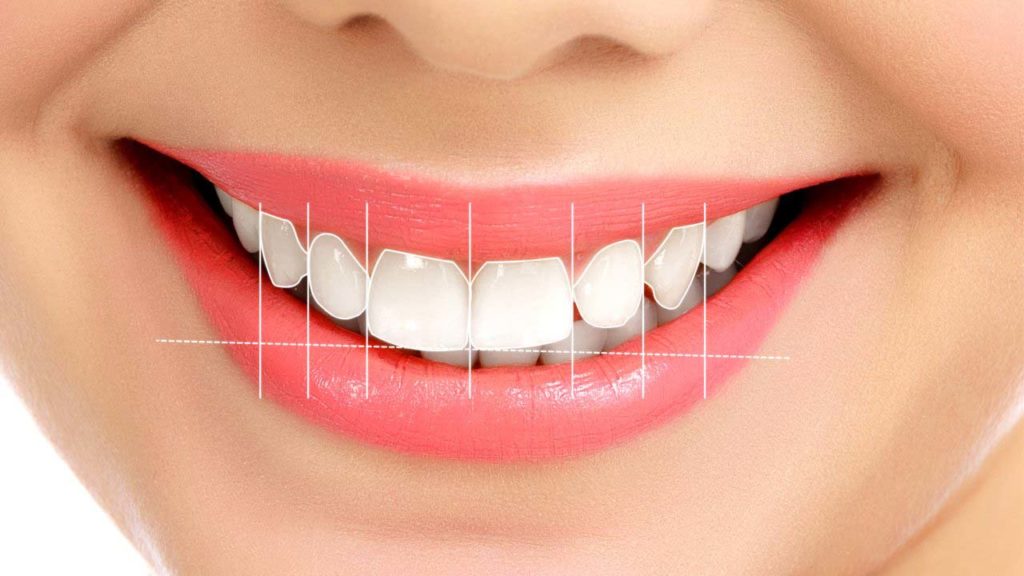 مشکلات عمده ترتيب دندان‌ها