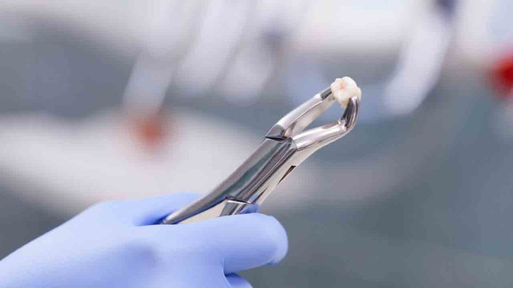 کشیدن دندان در ارتودنسی ثابت 