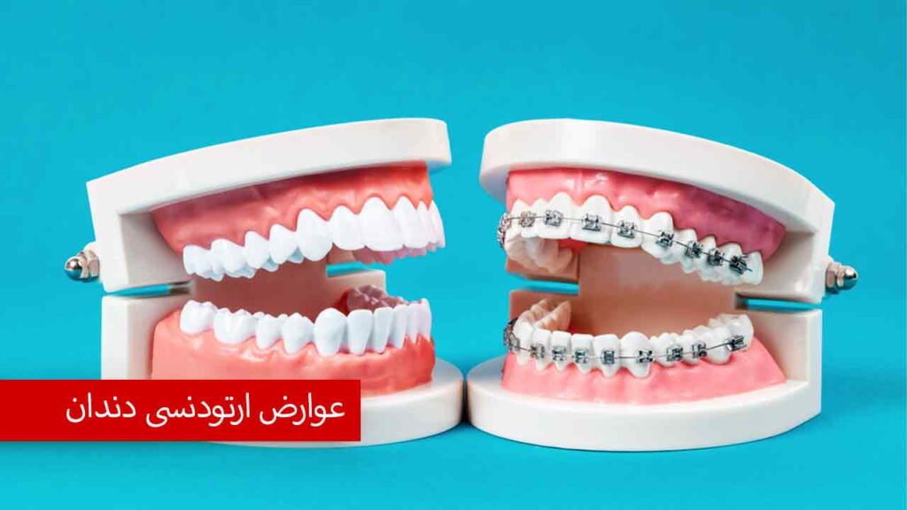عوارض ارتودنسی دندان